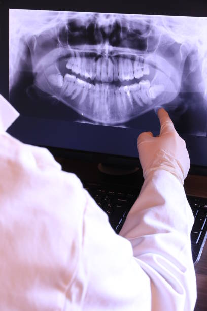 Best Emergency Treatment for Oral Infections in Boyertown, PA